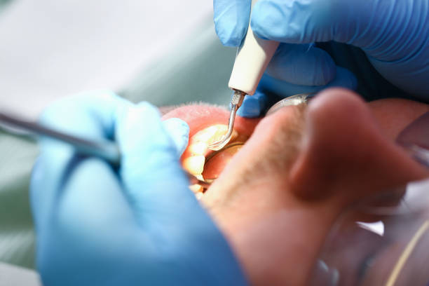 Best Cracked Tooth Emergency Dentist  in Fountain Valley, CA